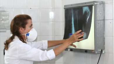 Photo of Normalmente usada como anticoagulante, heparina mostra potencial para tratar inflamação pulmonar